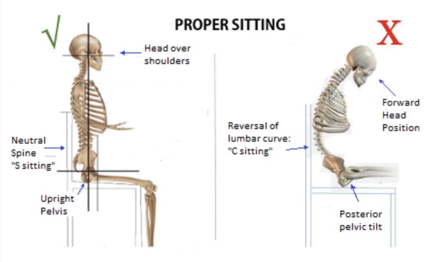 Forward head posture and pelvic tilt 