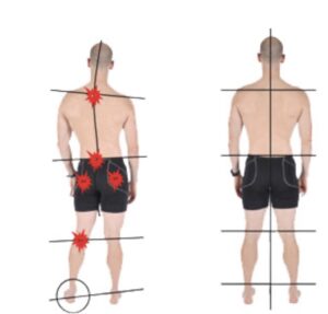 Pronation and posture