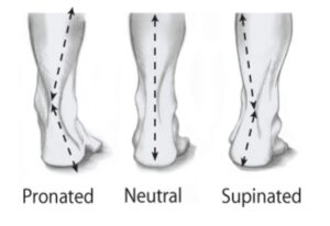 Foot alignment 