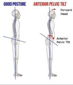 Standing Posture